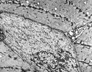 F,69y. | regenerating muscle cell